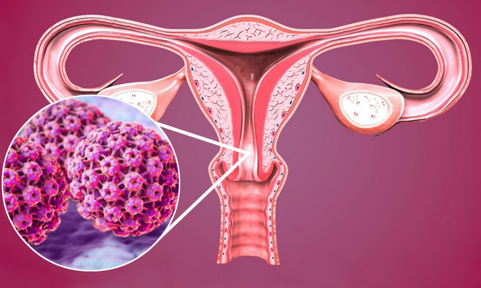 Você sabia que existe o PCR do câncer de colo de útero? Veja mitos e verdades sobre a doença