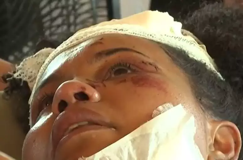 Sobrevivente de acidente que matou 24 acompanha velório da filha em maca na Bahia